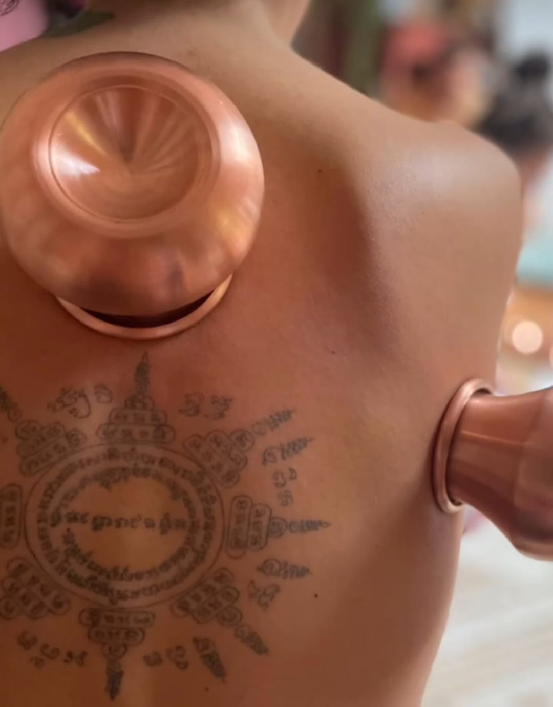 Ku Nye médecine tibétaine - cupping & Hijama